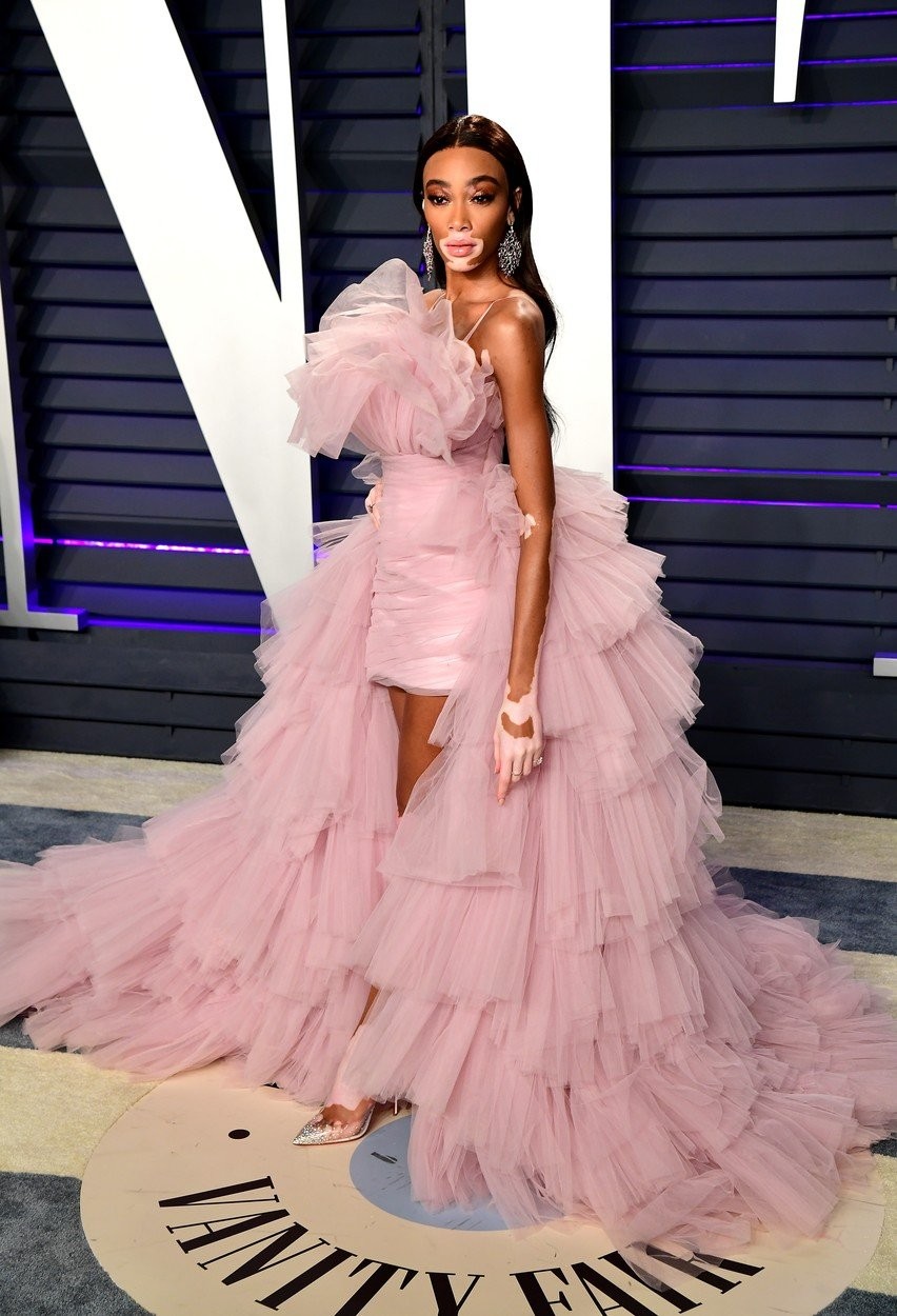 Winnie Harlow