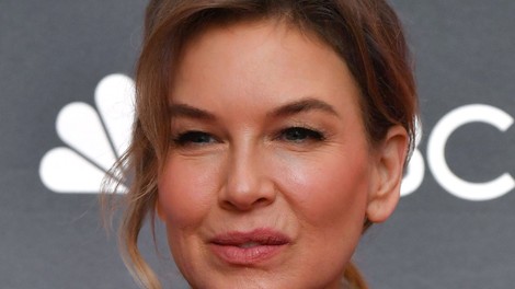 Renée Zellweger si je skrajšala lase in izgleda odlično! Njen frizer je razkril, da ga je navdihnila pričeska Davida Bowieja