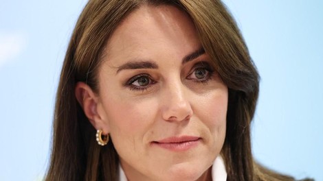"Težko bo": Oglasil se je kirurg Kate Middleton in razkril neznane podrobnosti operacije in okrevanja