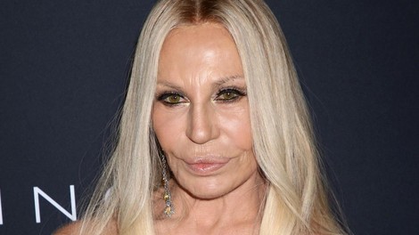 Donatella Versace plastična operacija