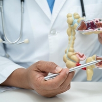 Holesterola ne dobimo iz jajc, slanine in pečenke ampak iz te hrane. "To uničuje jetra," trdi doktor