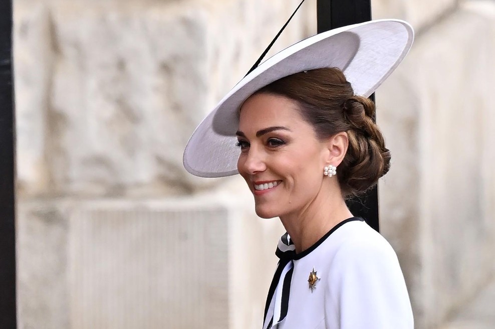 3 deli telesa, ki jih elegantne ženske, kot je Kate Middleton, vedno skrijejo pod oblačili (foto: Profimedia)