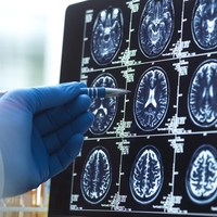 Nevrolog: "Za ohranjanje zdravih možganov in ostrega spomina se izogibam 4 navadam, ki jih ljudje počnejo vsak dan"