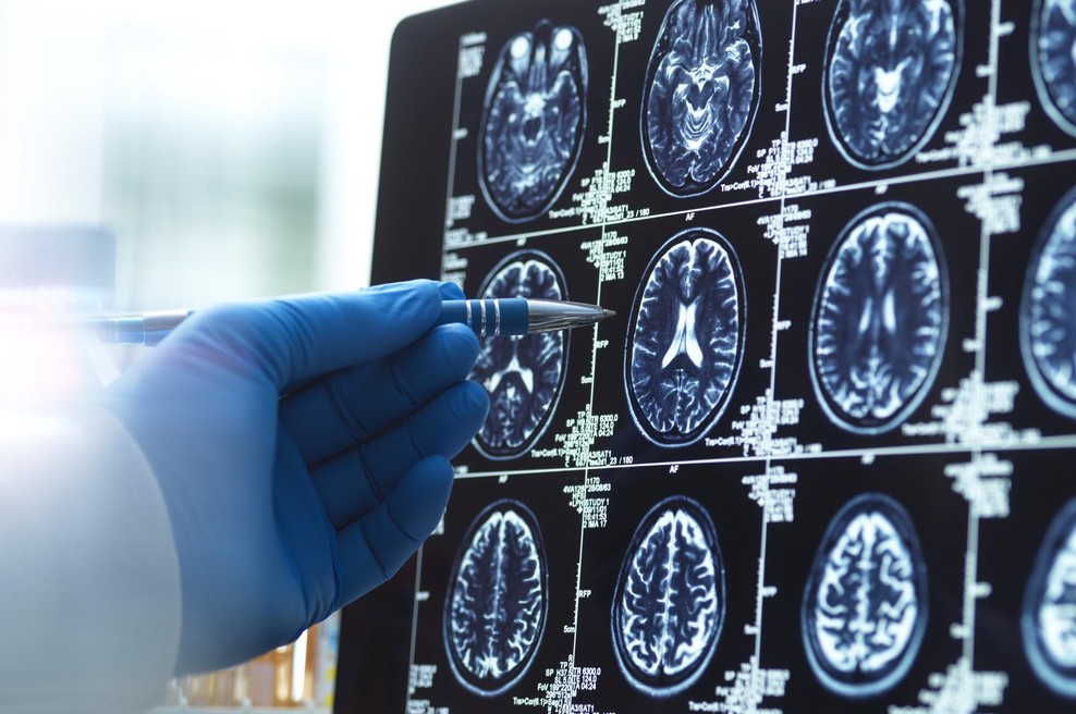 Nevrolog: "Za ohranjanje zdravih možganov in ostrega spomina se izogibam 4 navadam, ki jih ljudje počnejo vsak dan" (foto: Profimedia)