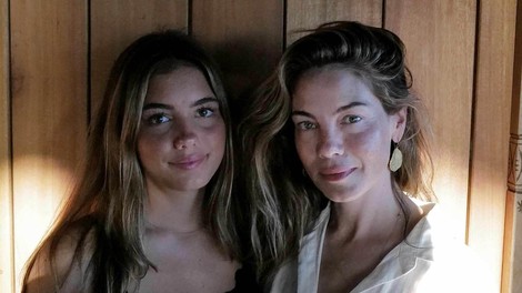 14 živil, ki pospešujejo staranje kože: Po 50. letu bi se jim morali izogibati