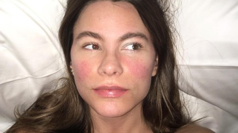 Ta pogosta zimska težava je lahko zgodnji znak pljučnega raka: če se vleče dlje časa, obvezno obiščite zdravnika