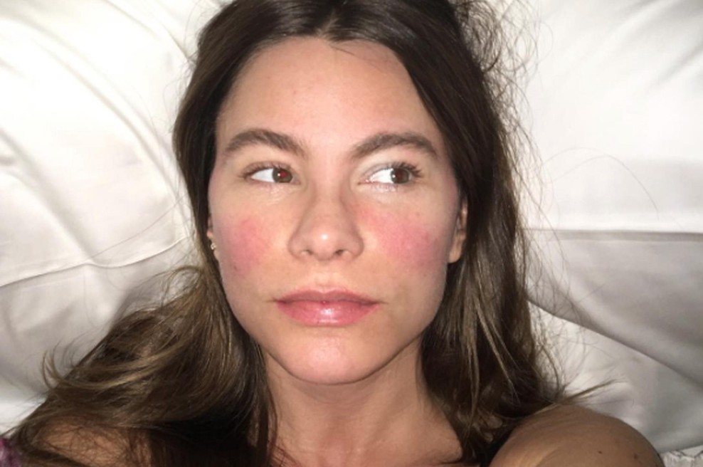 Ta pogosta zimska težava je lahko zgodnji znak pljučnega raka: če se vleče dlje časa, obvezno obiščite zdravnika (foto: Profimedia)