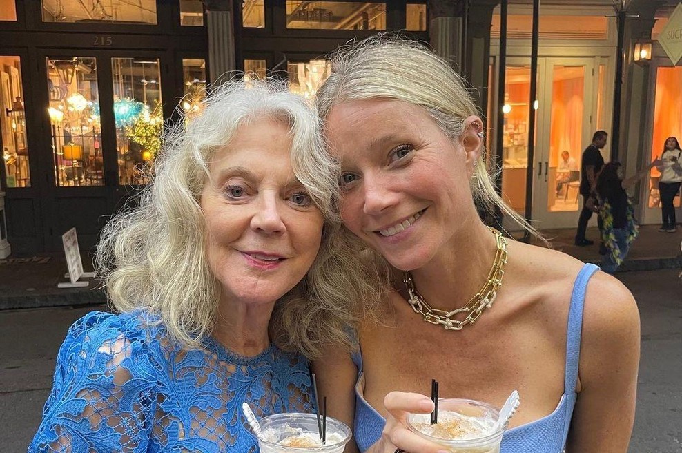 Osteopat razkriva enostaven test, ki razkrije, kako hitro se bo postaral vaš obraz (foto: Profimedia)