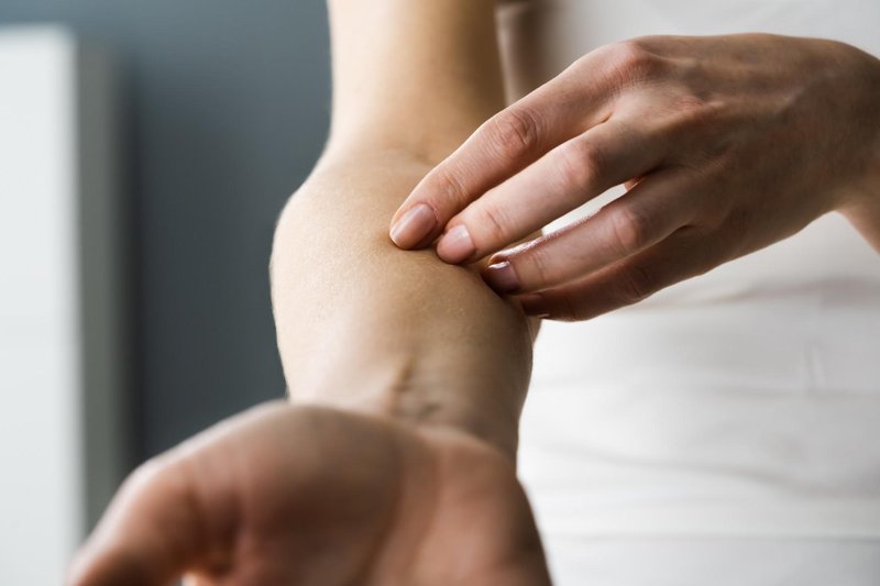 Ta znak na koži opozarja na bolezni srca, svarijo dermatologi