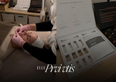 Manj boleč, a bolj učinkovit: preizkusili smo SQT biomicroneedling in to so rezultati!