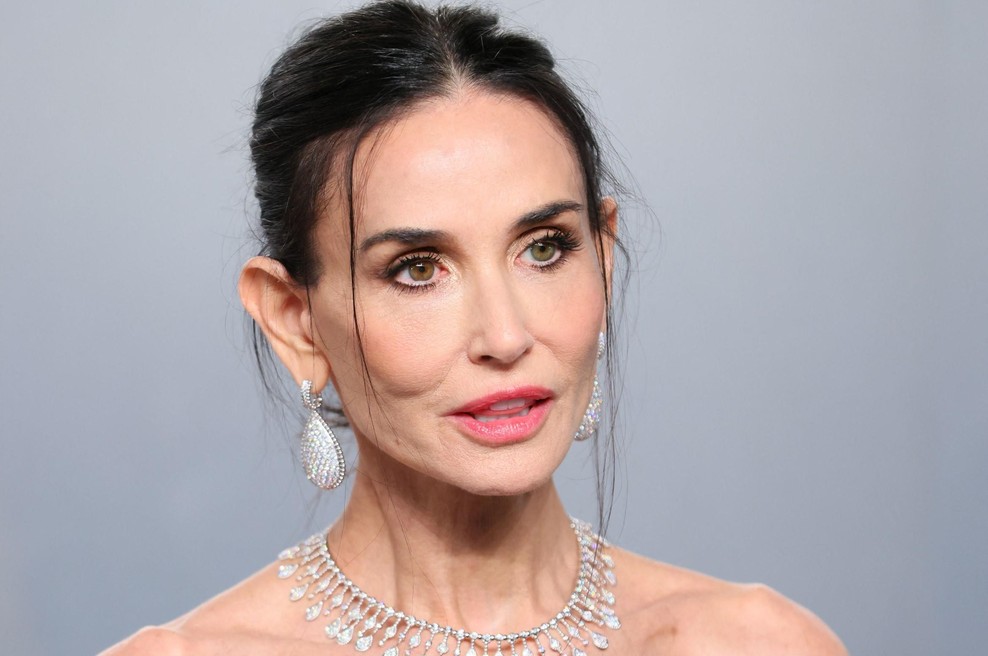 Podelitev oskarjev je potrdila: Ozempic je prevzel Hollywood (foto: Profimedia)