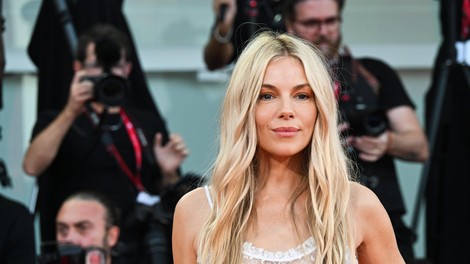 Sienna Miller uporablja serum, ki ga mnogi opisujejo kot alternativo botoksu