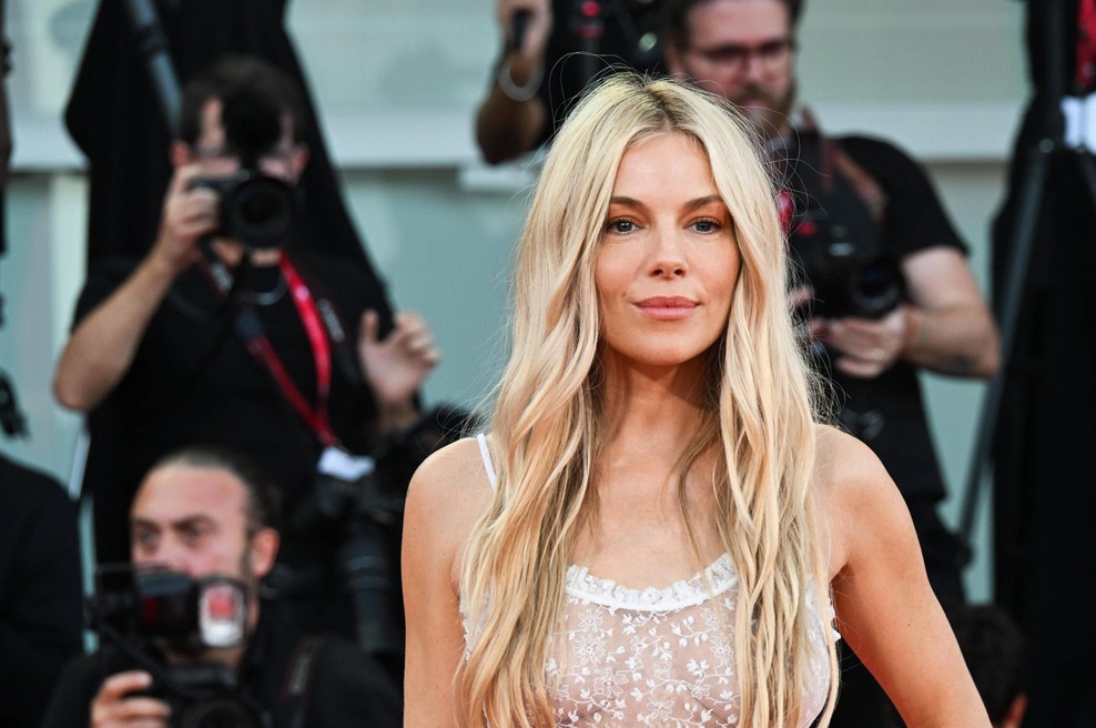 Sienna Miller uporablja serum, ki ga mnogi opisujejo kot alternativo botoksu (foto: Profimedia)
