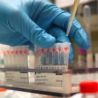 Največ ljudi, ki dočakajo 100 let, ima to krvno skupino