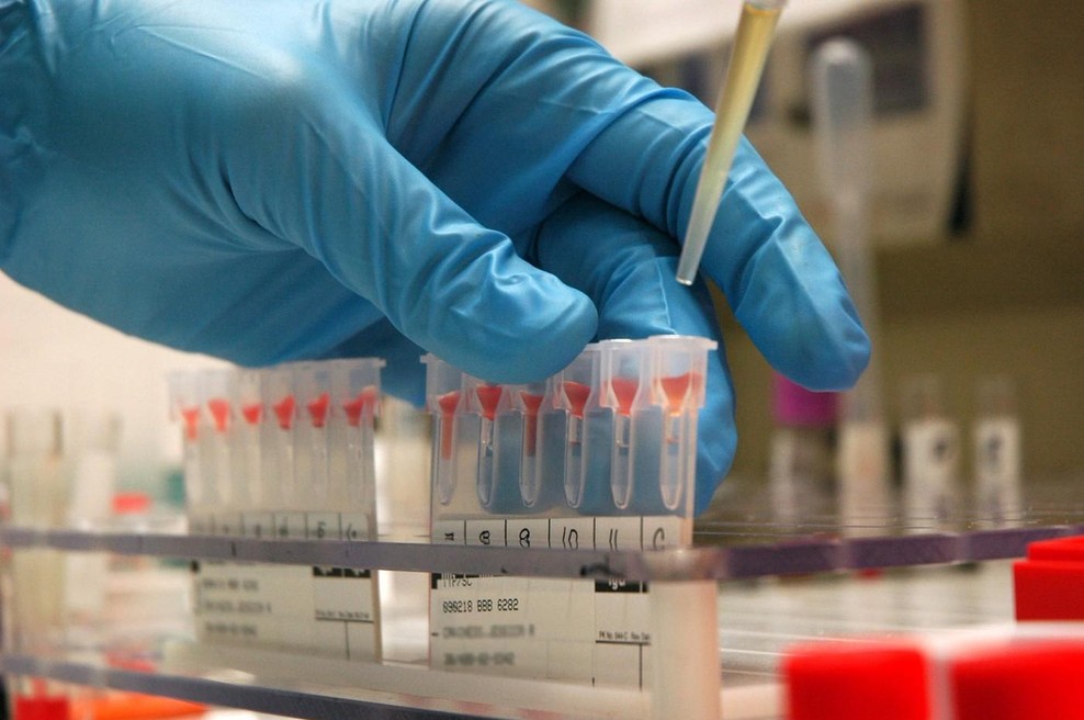 Največ ljudi, ki dočakajo 100 let, ima to krvno skupino (foto: Profimedia)