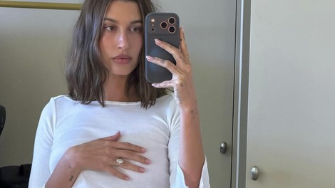 Hailey Bieber vsako jutro popije "shot" kozarček tega (pravi, da gre za naravni detox)
