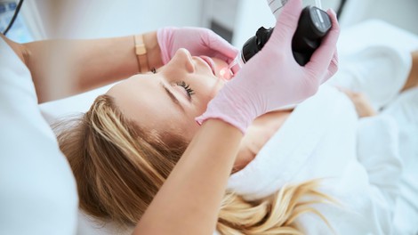Ta znak na koži opozarja na bolezni srca, svarijo dermatologi