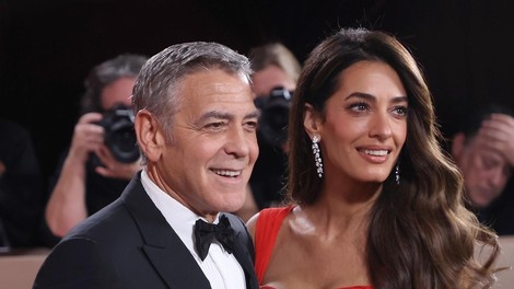 Trik Amal Clooney za neukrotljive lase: tako bodo vedno izgledali sijoče in brez razmršenosti